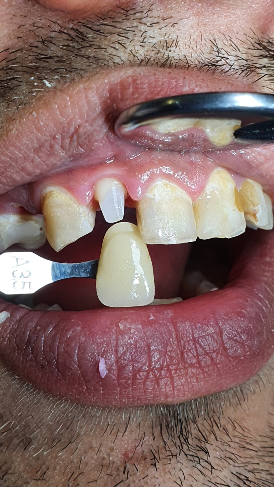 František Weber - soukromá zubní laboratoř foto 2