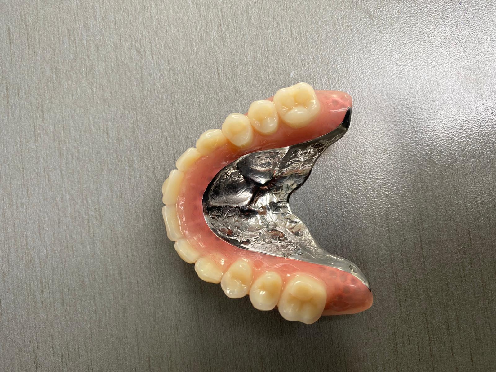 František Weber - soukromá zubní laboratoř foto 3