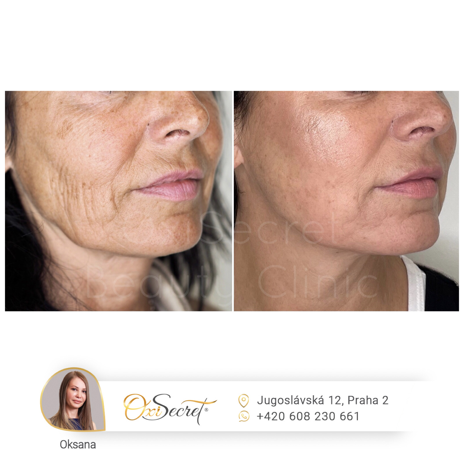 Oxisecret Beauty Clinic foto 3