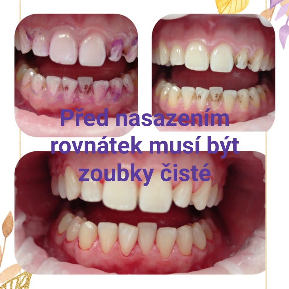 Iveta Stará, DiS. Profesionální dentální hygiena foto 3