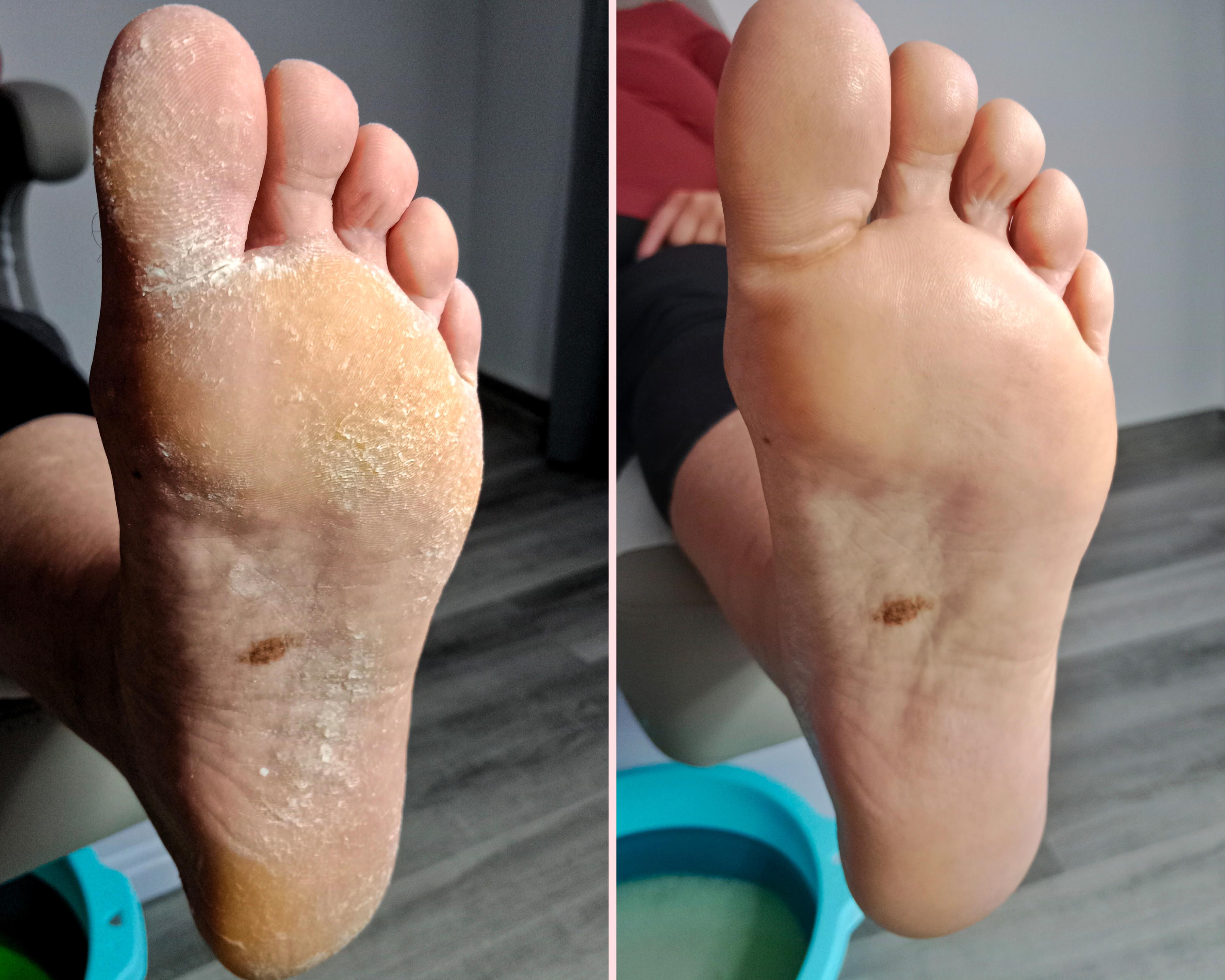 Pedi Markét foto 3