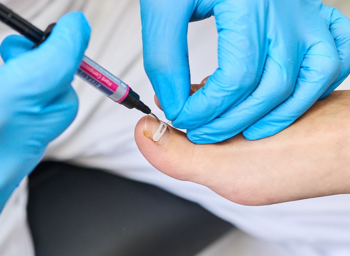 Podologie Jana Kubešová foto 6