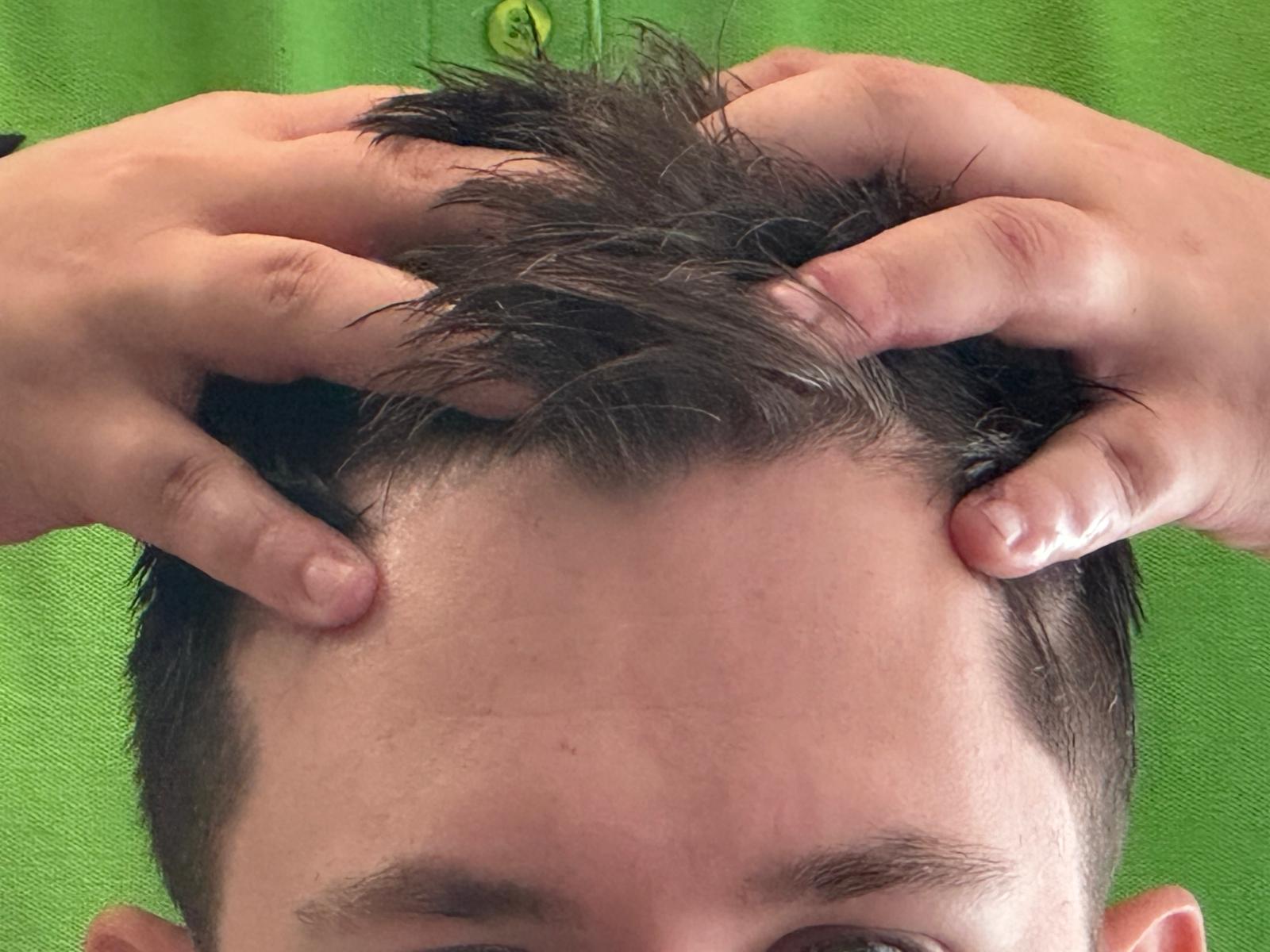 Relaxační masáž hlavy na prokrvení kořínku vlasů