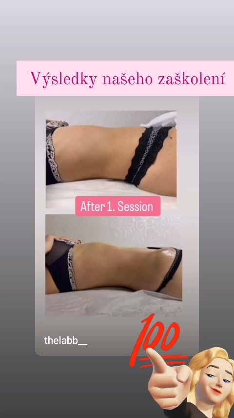 Certifikované kurzy Maderoterapie foto 2 (náhled videa)