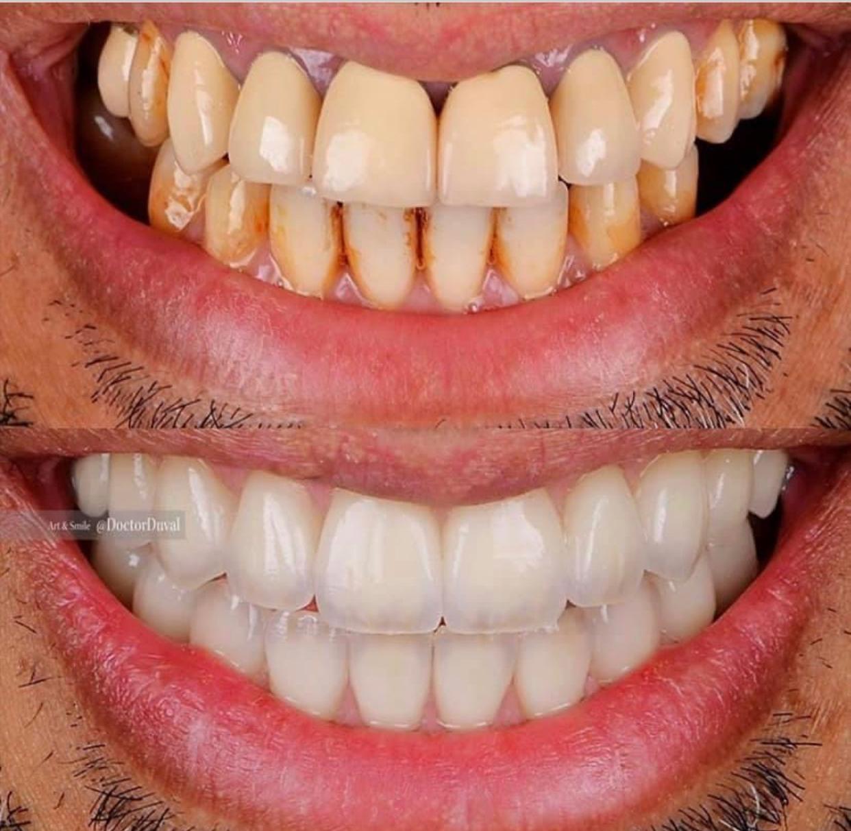 František Weber - soukromá zubní laboratoř foto 4