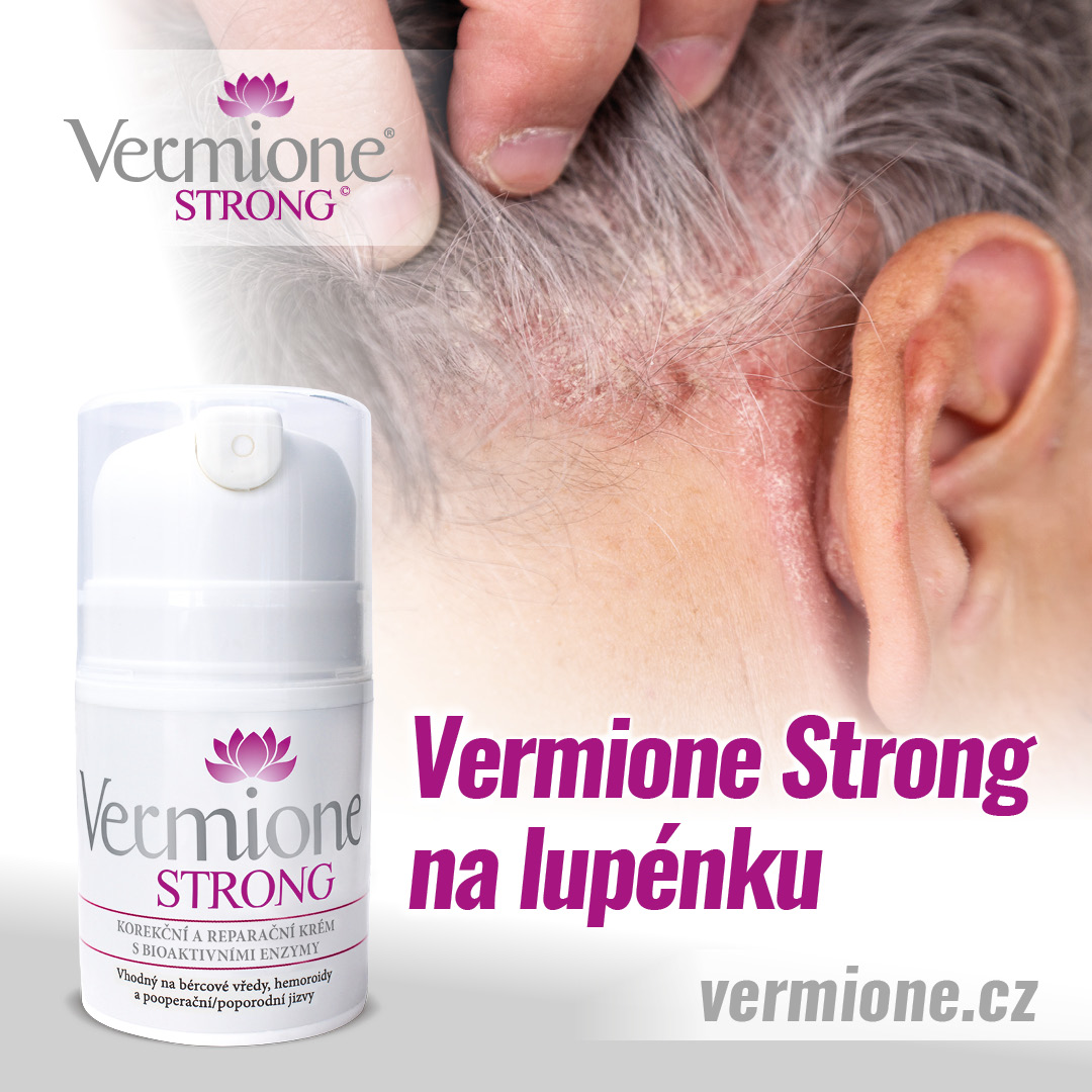 Vermione.cz foto 6