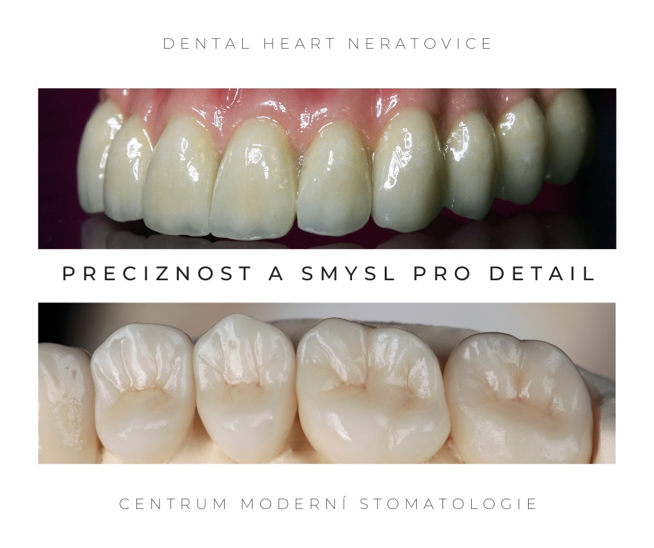 Dental Heart - moderní stomatologie foto 4