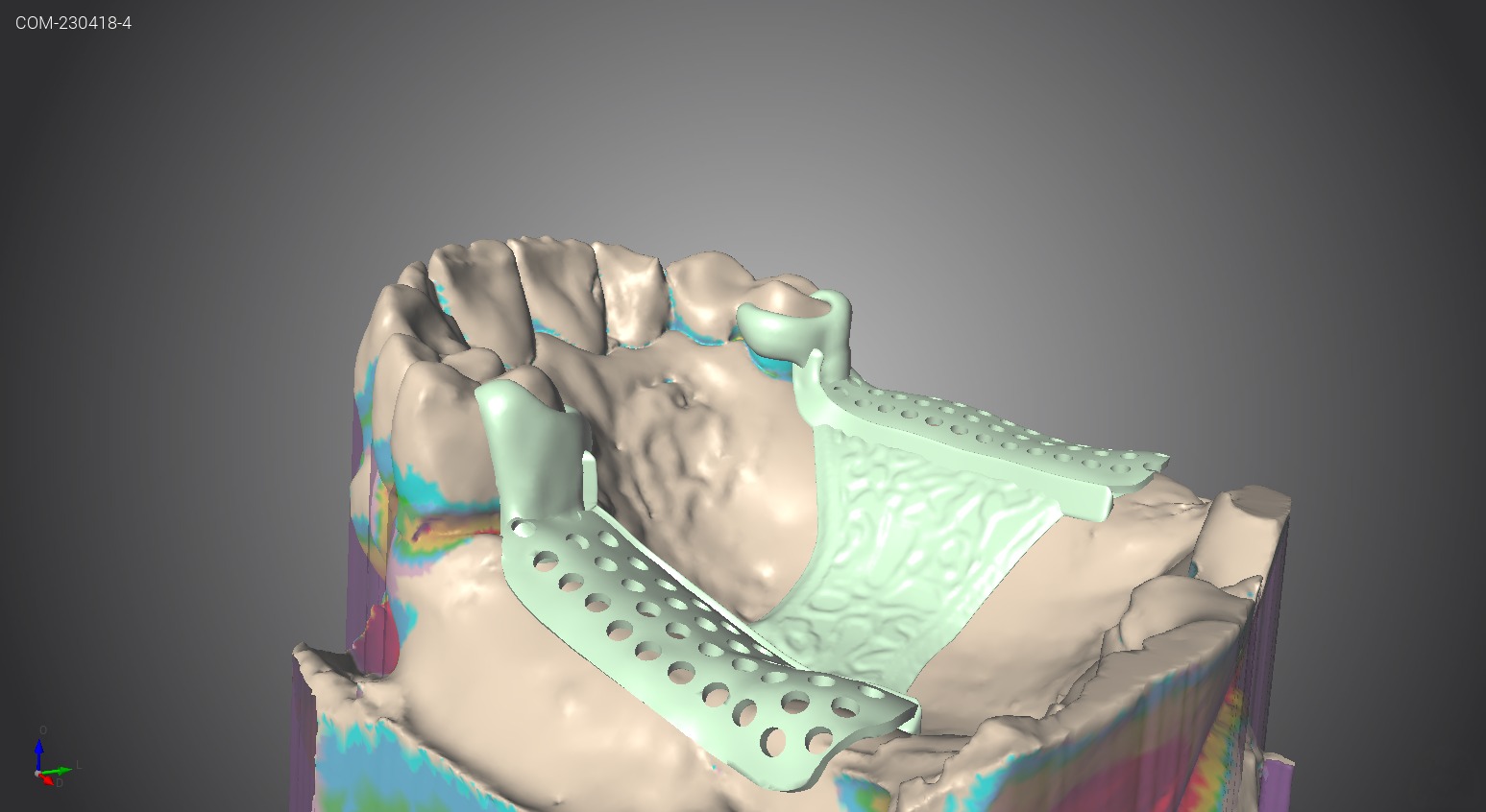 Filip Zachoval foto 4
