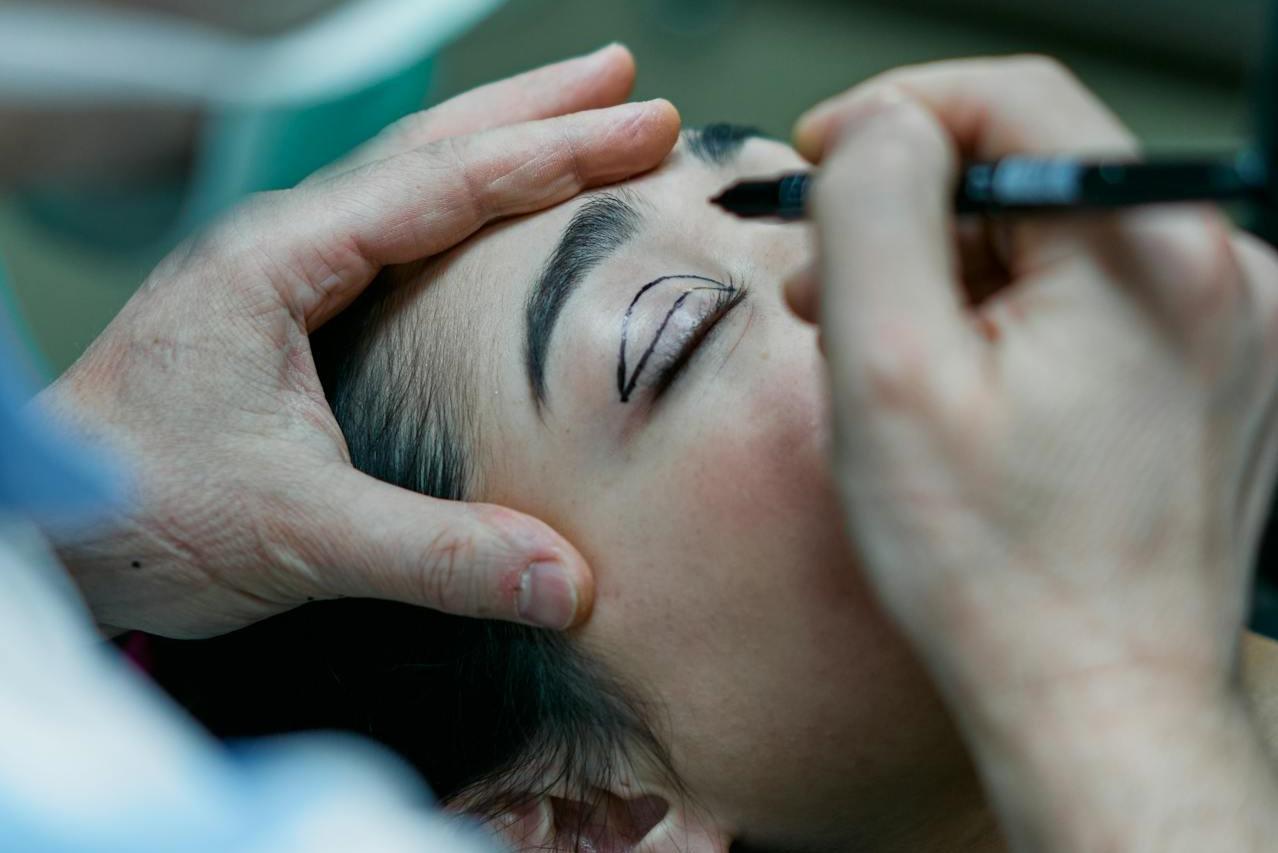 Plastická operace horních či dolních víček