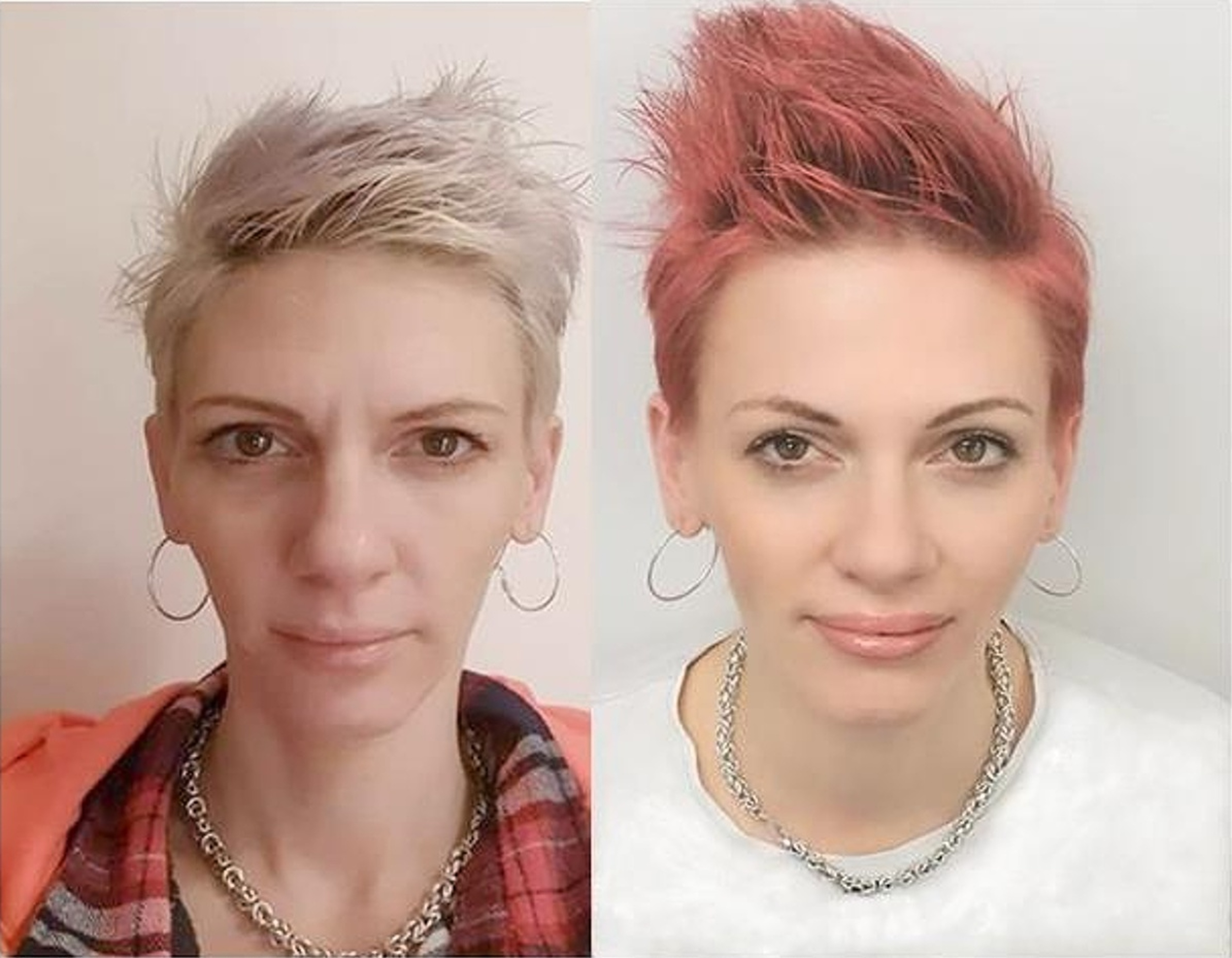 Omlazovna Kateřiny Schlosserové foto 4