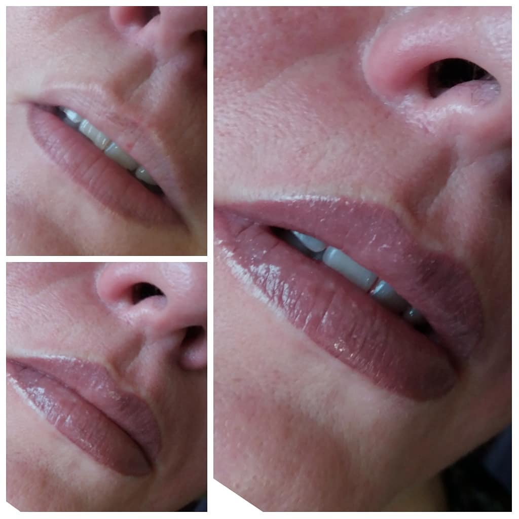 Dermosalon foto 5