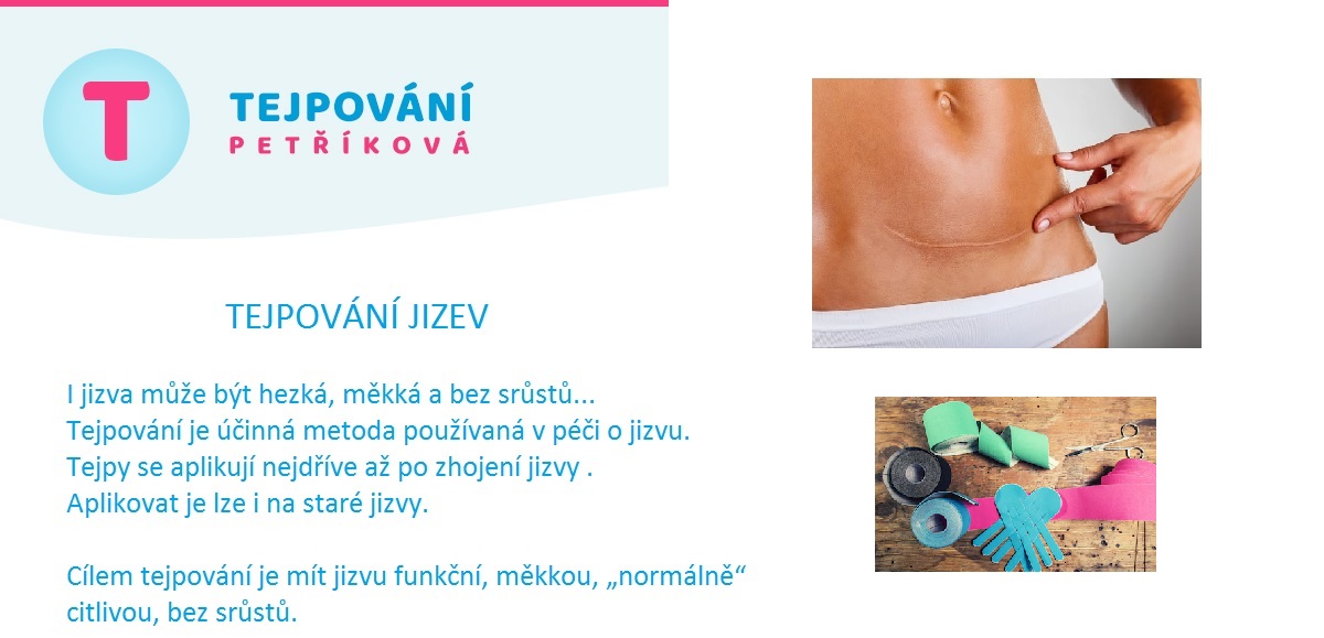 Tejpování Petříková foto 2