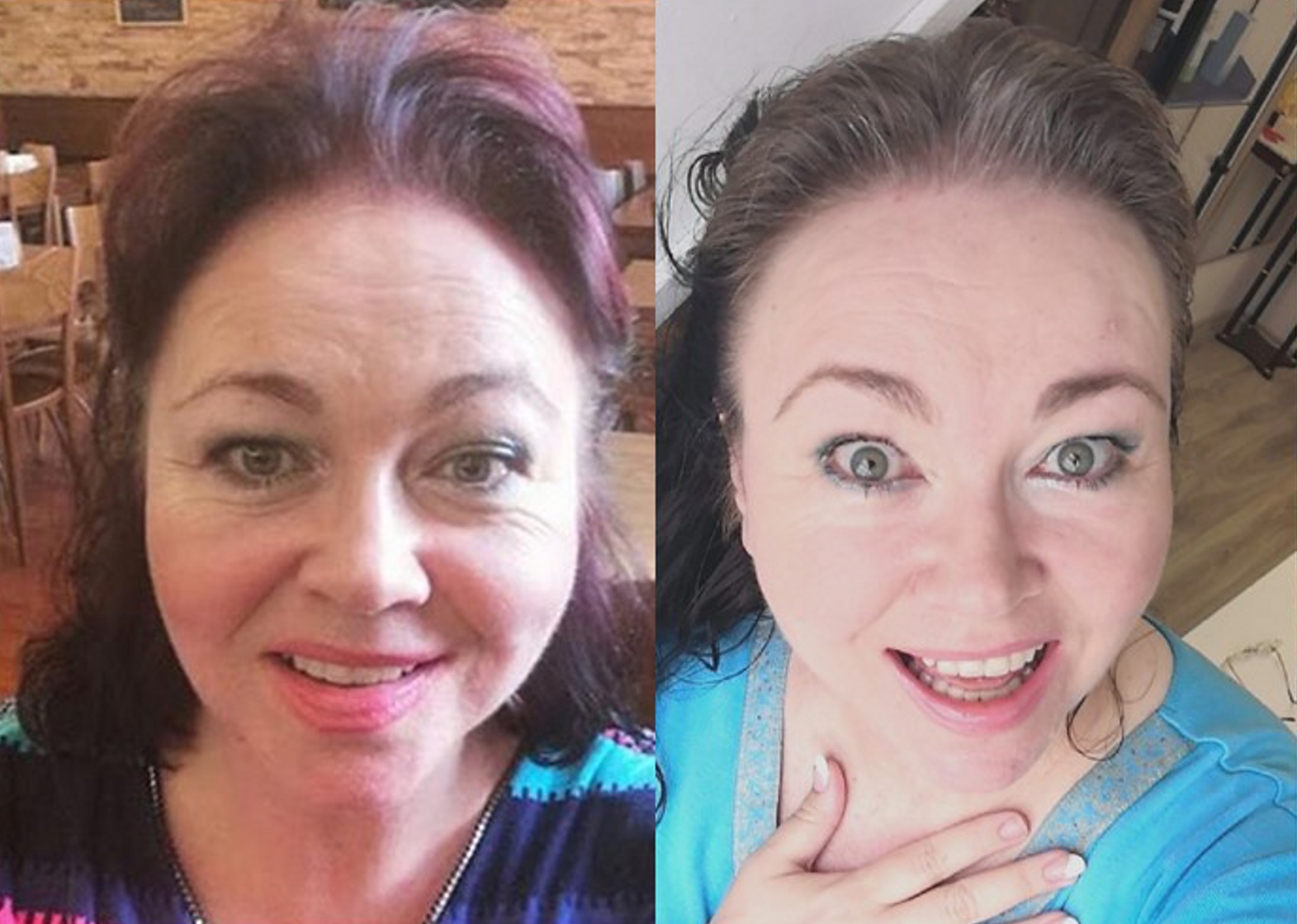 Omlazovna Kateřiny Schlosserové foto 4