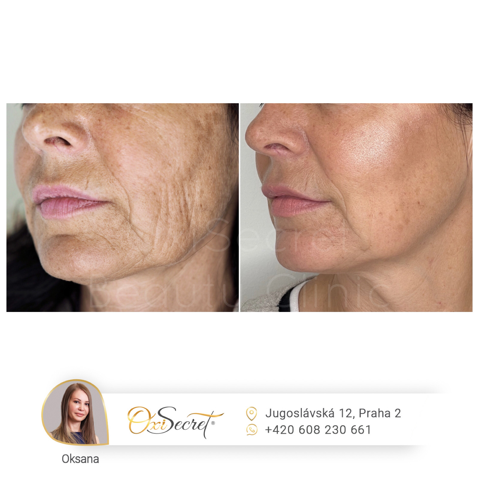 Oxisecret Beauty Clinic foto 4