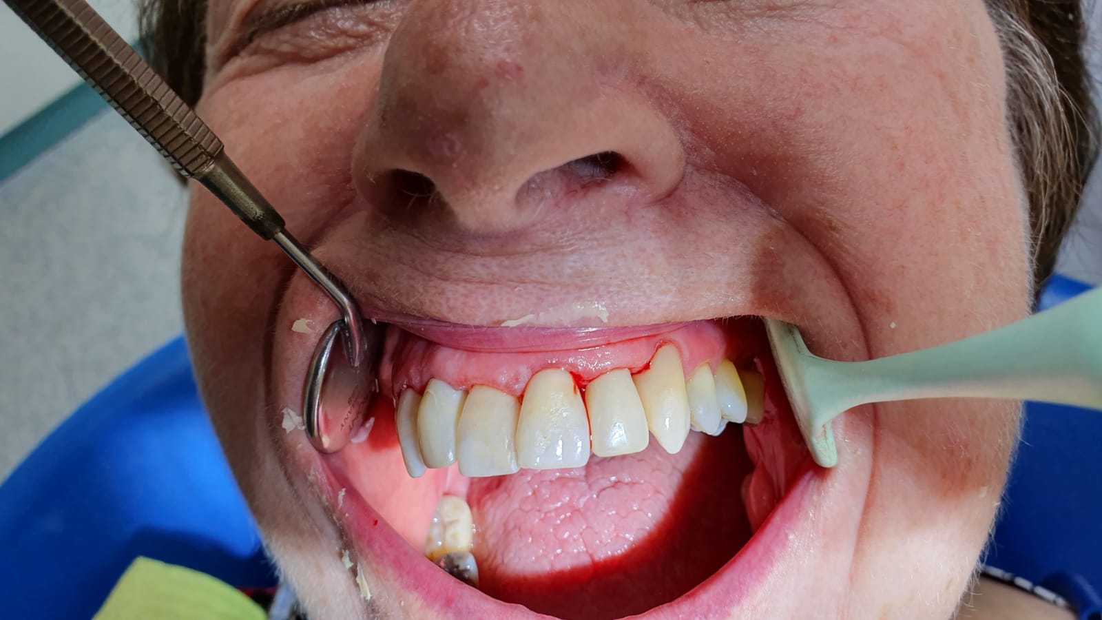 František Weber - soukromá zubní laboratoř foto 4