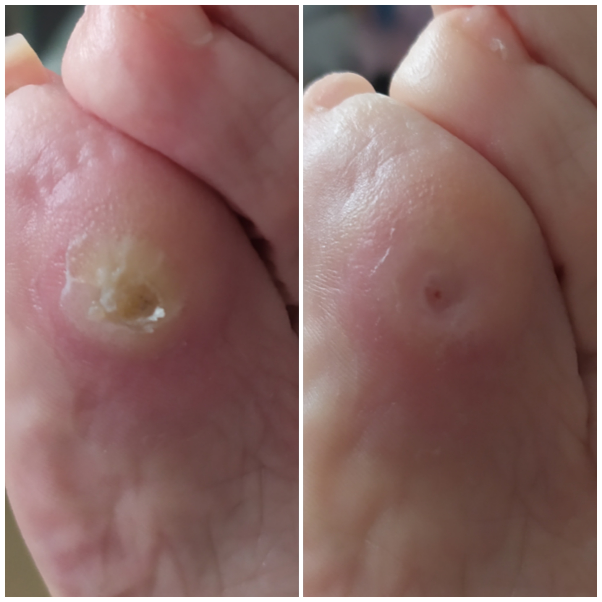 Mobilní Pedikúra Dáša foto 4