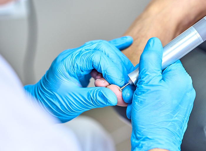 Podologie Jana Kubešová foto 4