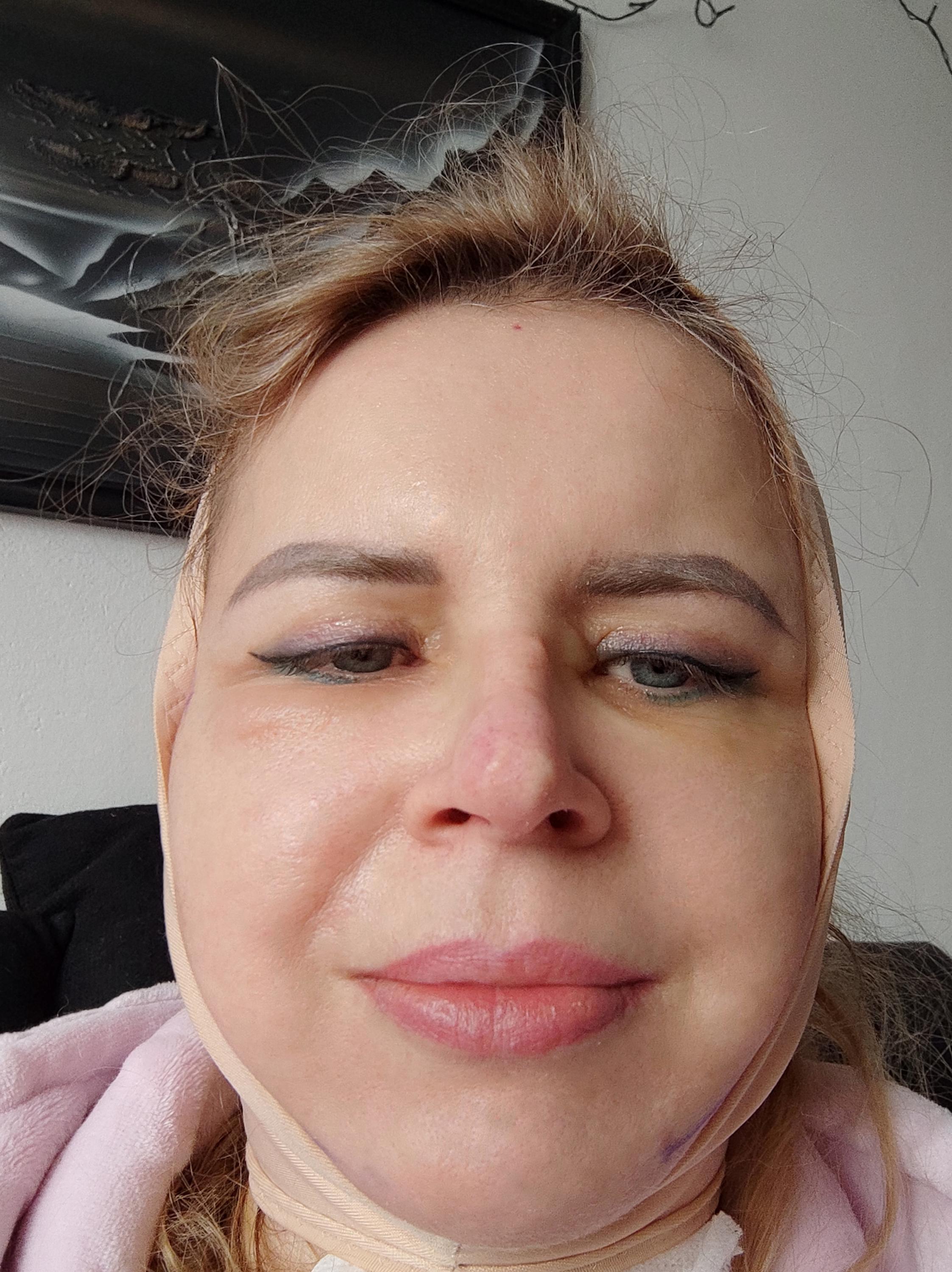 CBP KLINIKA plastická chirurgie foto 6