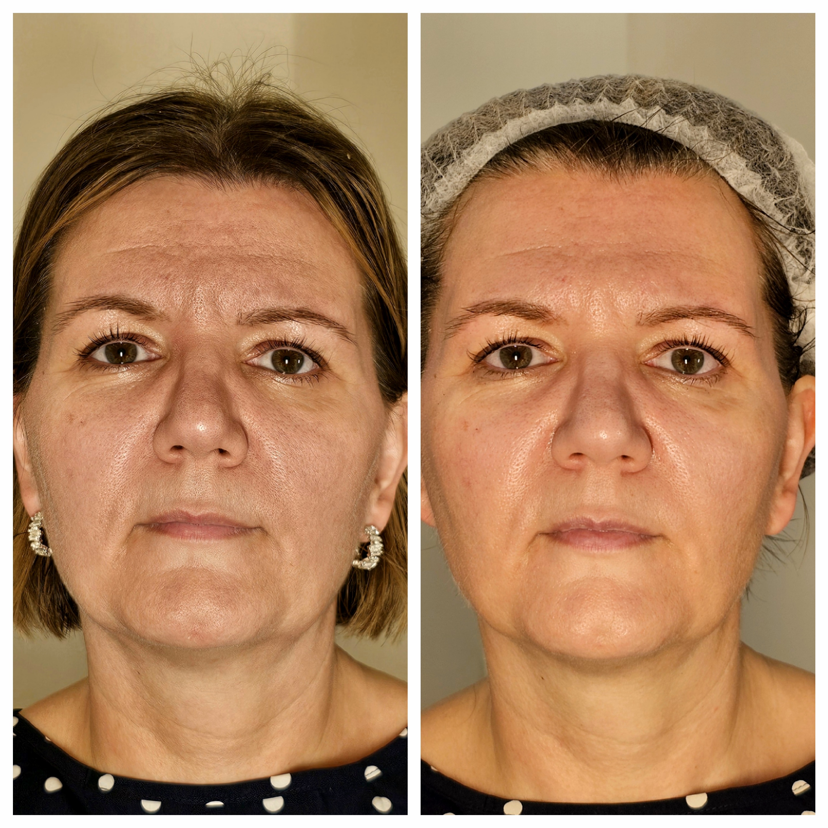 Alttera beauty studio foto 4