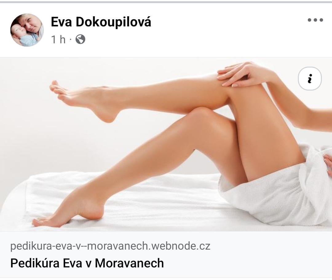 Pedikúra Eva Dokoupilová foto 2