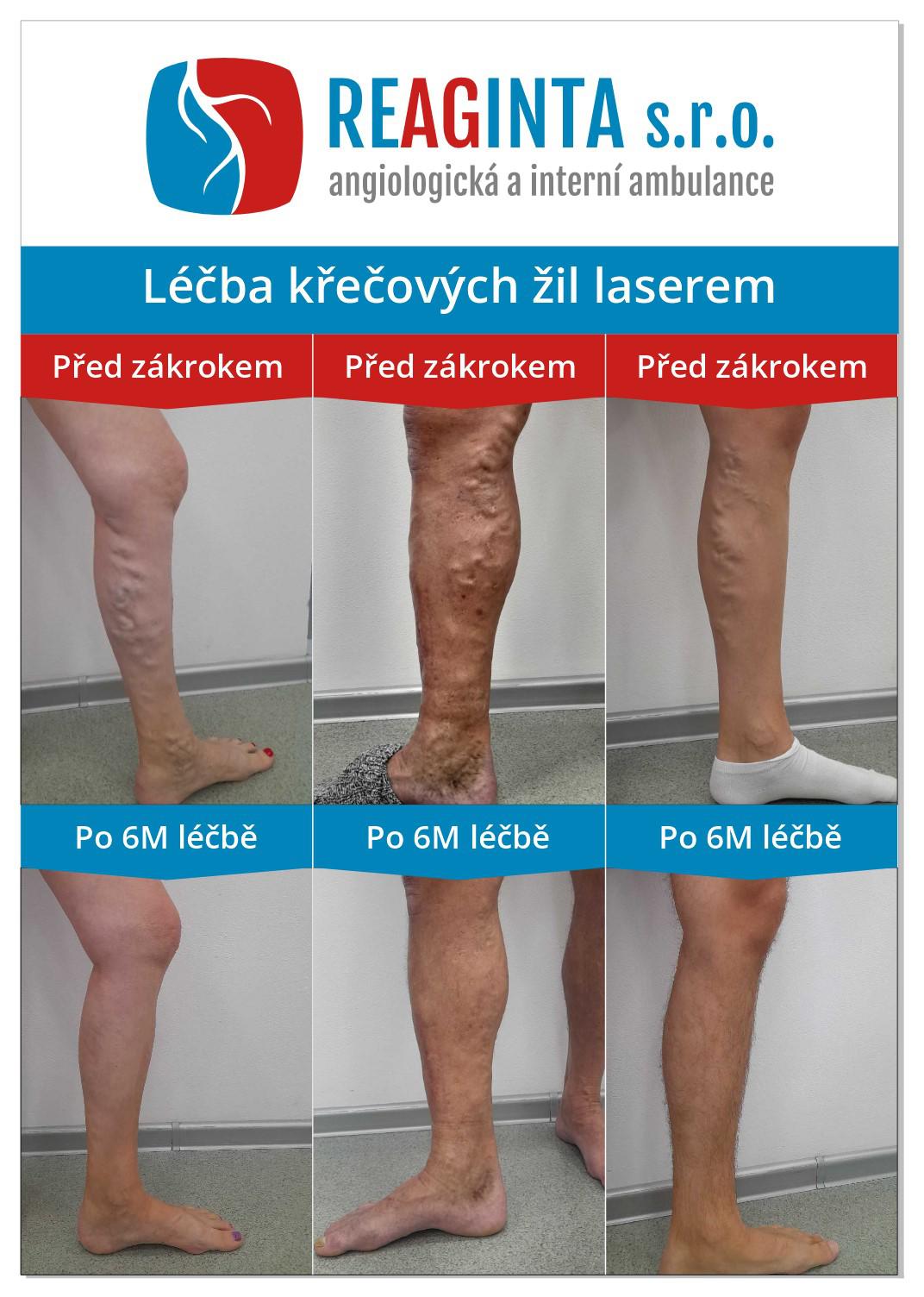 Cévní ambulance - REAGINTA s.r.o. foto 3