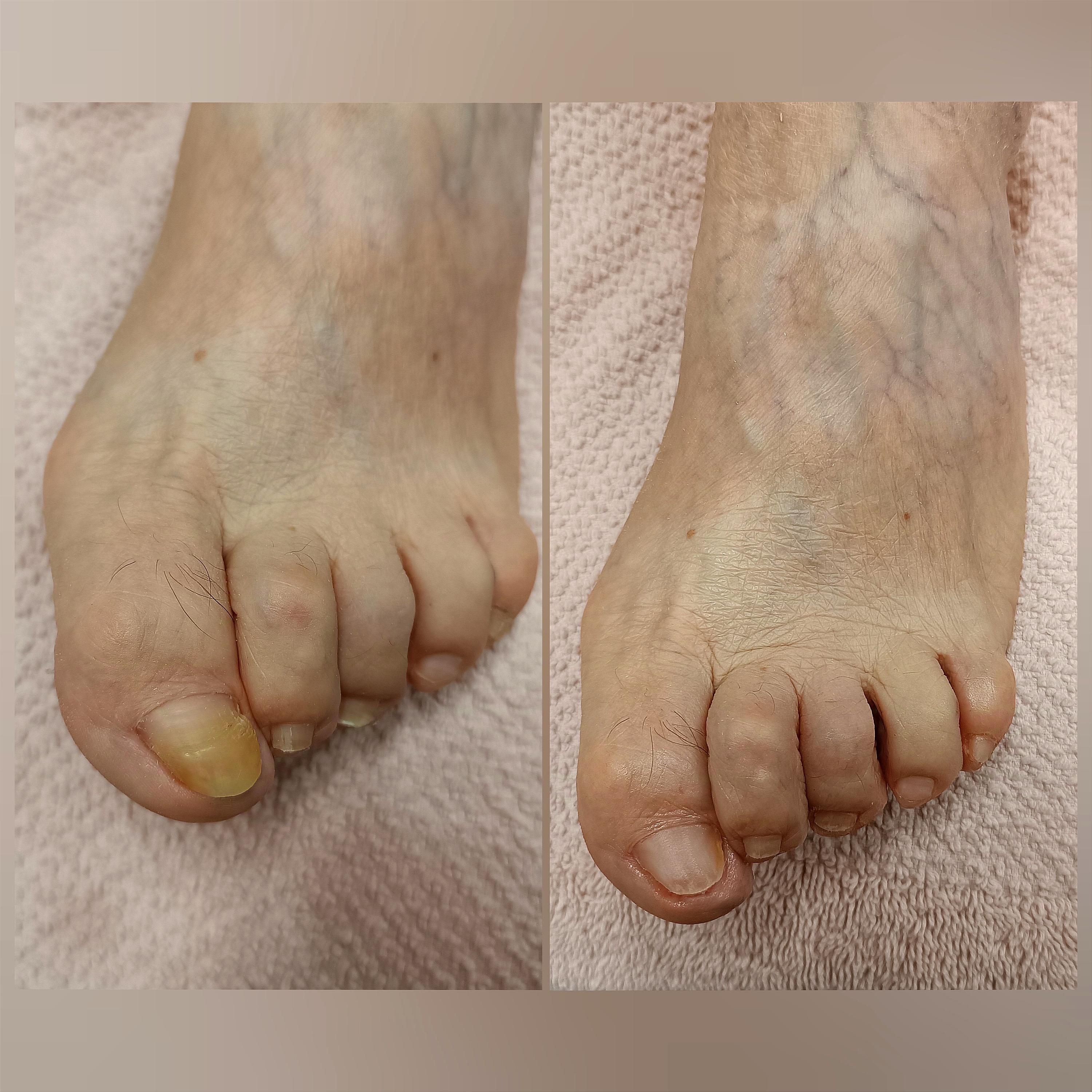 Pedikúra Tereza Hošková foto 6