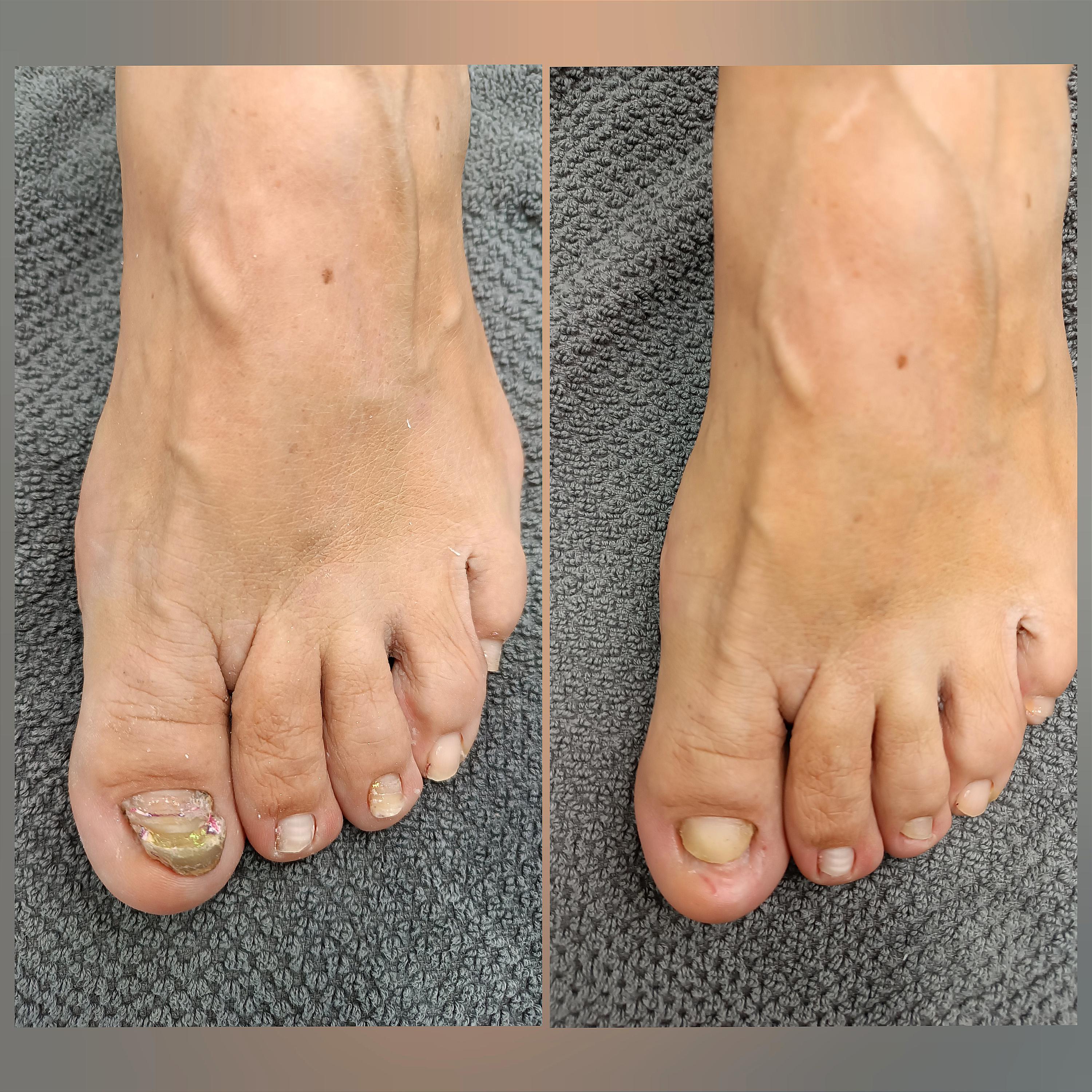 Pedikúra Tereza Hošková foto 4