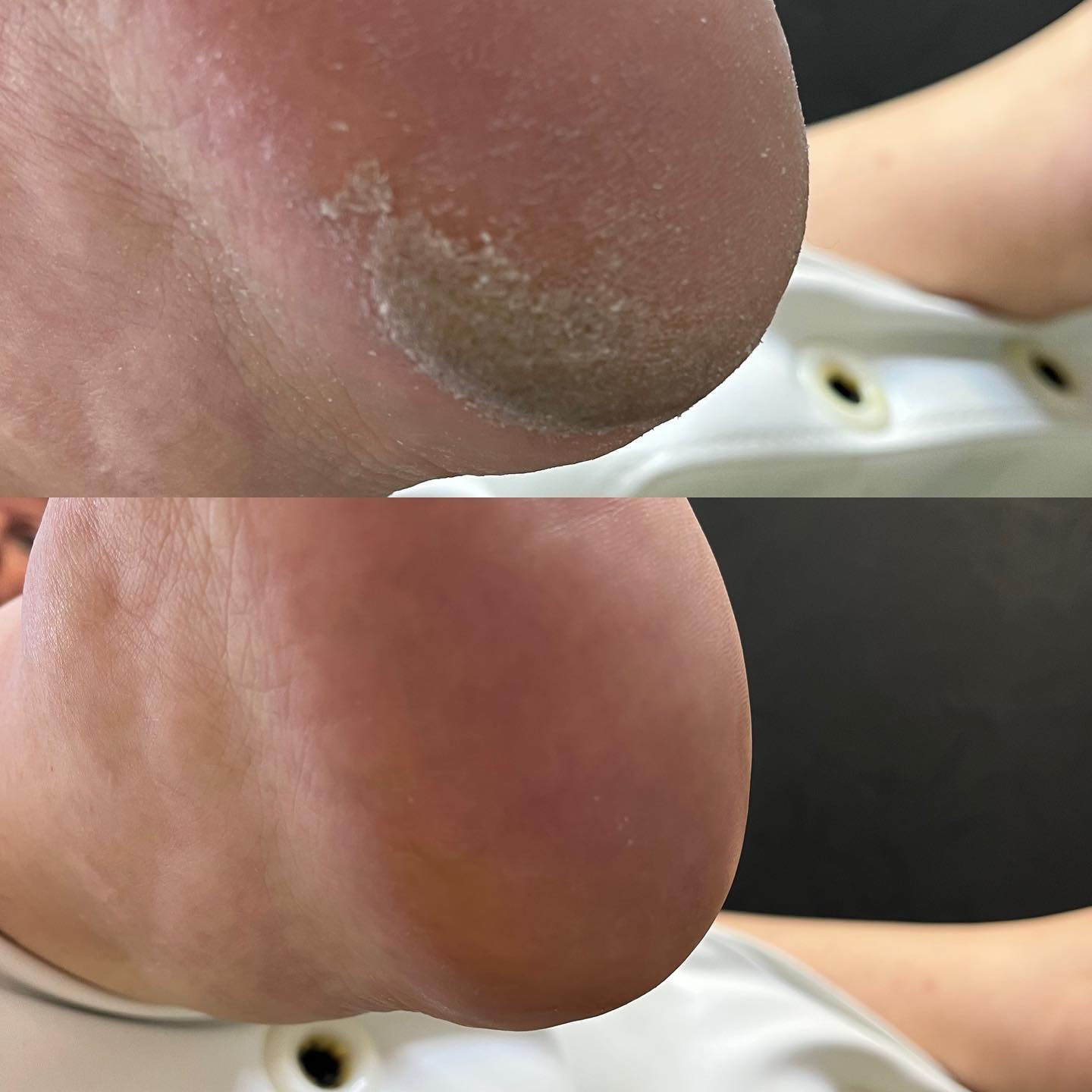 Adéla Bednářová – Foot Therapy (pedikúra) foto 4