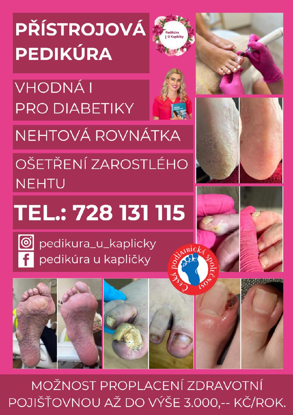 Pedikúra u Kapličky foto 4