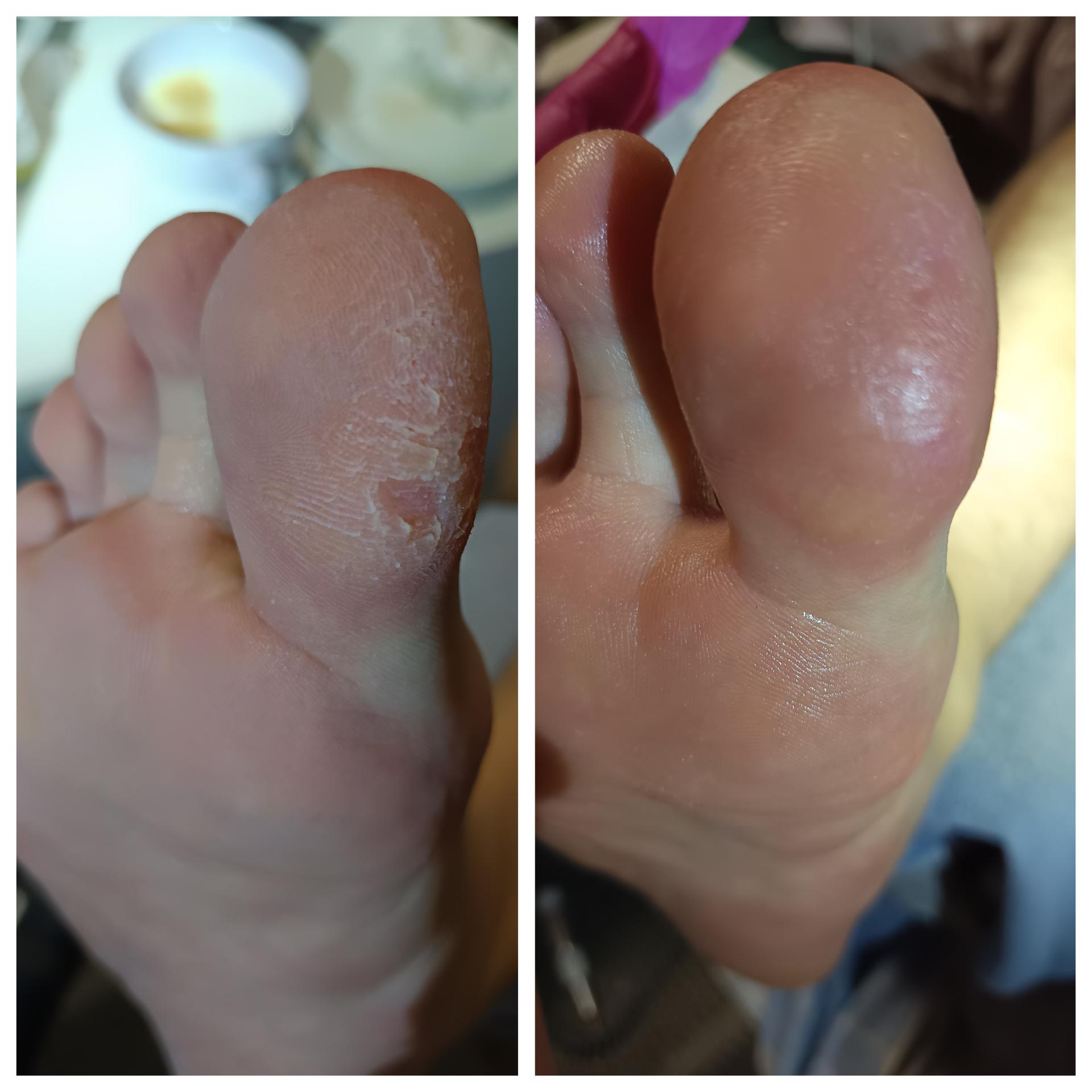 Mobilní Pedikúra Margaret foto 3