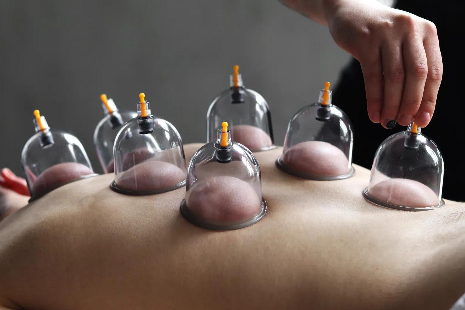 Masáže Plzeň - Baňková masáž zad a šíje 40 minut