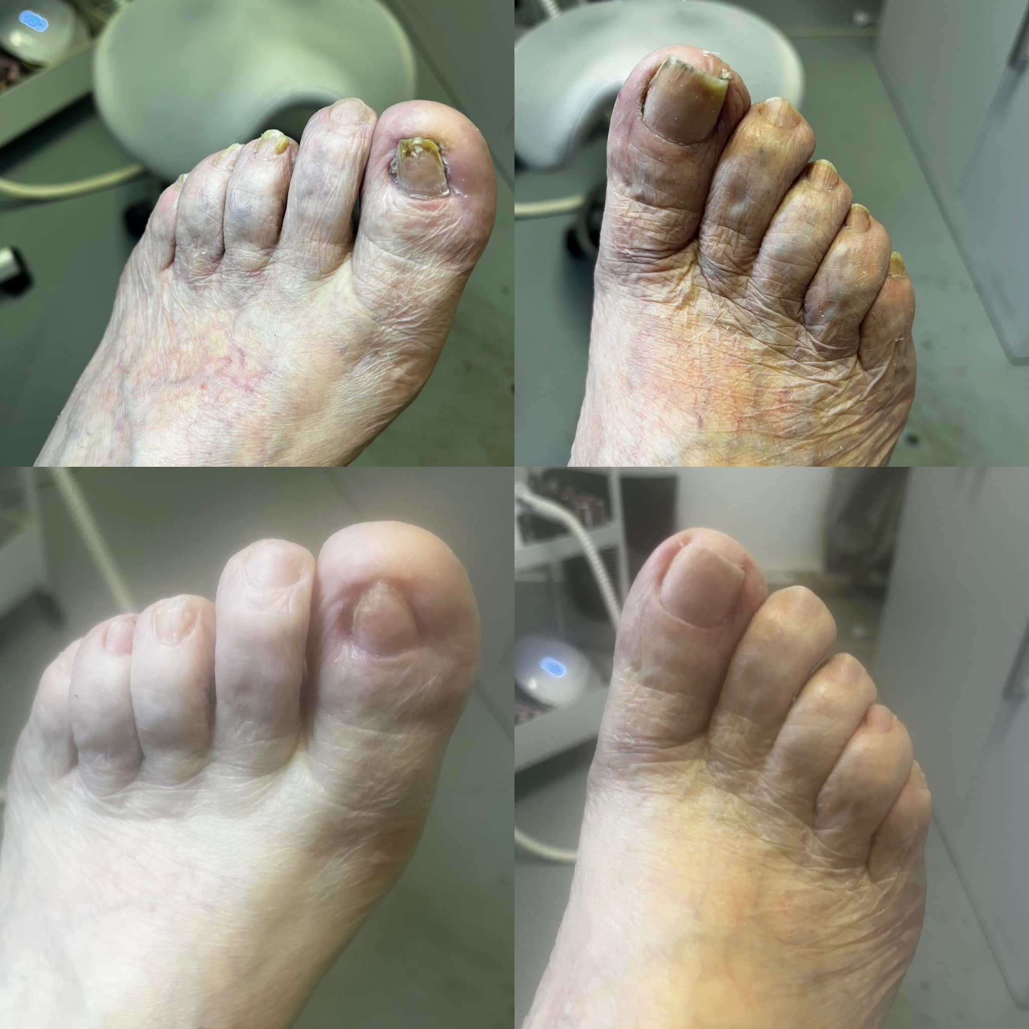 Adéla Bednářová – Foot Therapy (pedikúra) foto 3