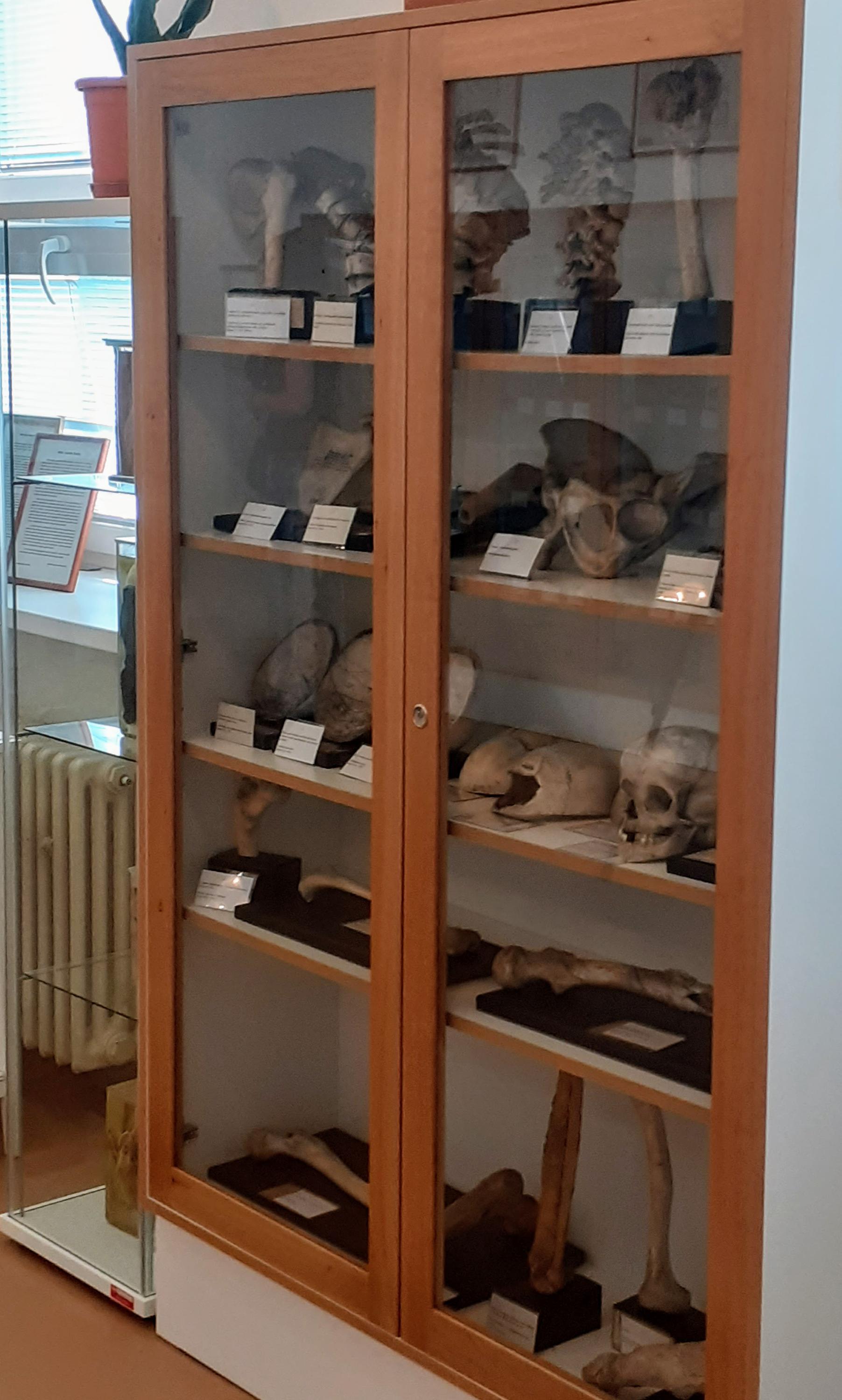 Muzeum patologie - Moravskoslezská nemocnice Opava foto 3