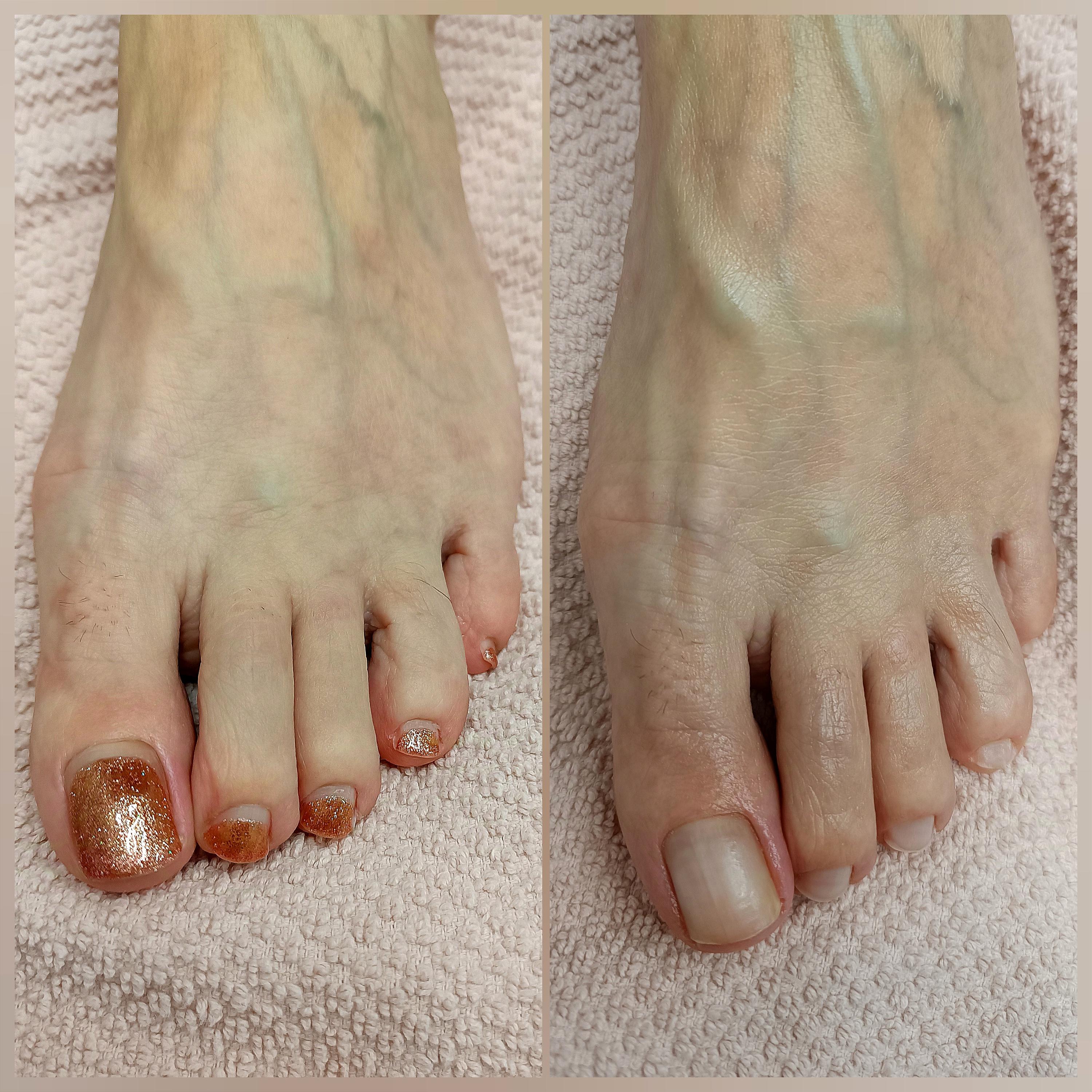 Pedikúra Tereza Hošková foto 2