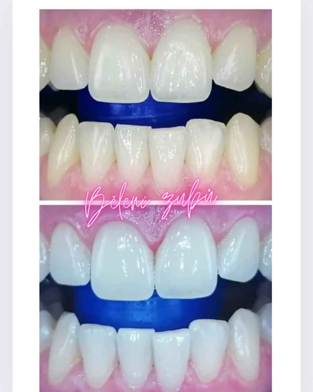 LuciDent profesional foto 3