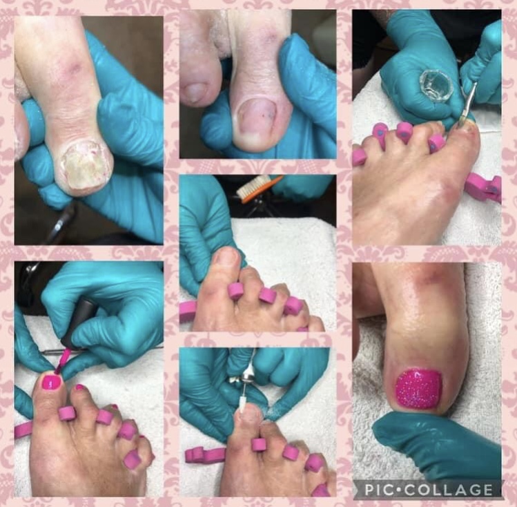 Pedikúra do domu Eva Krahulová foto 2