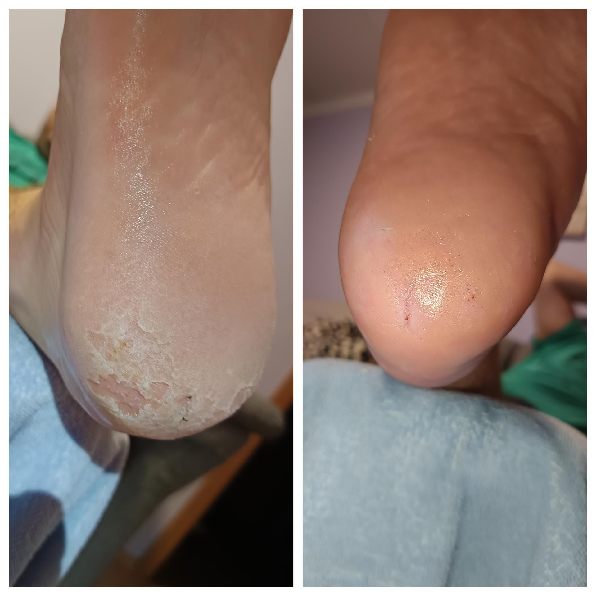 Mobilní Pedikúra Margaret foto 2