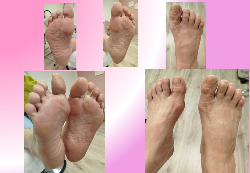 Pedikúra & Manikúra LKŠ foto 3