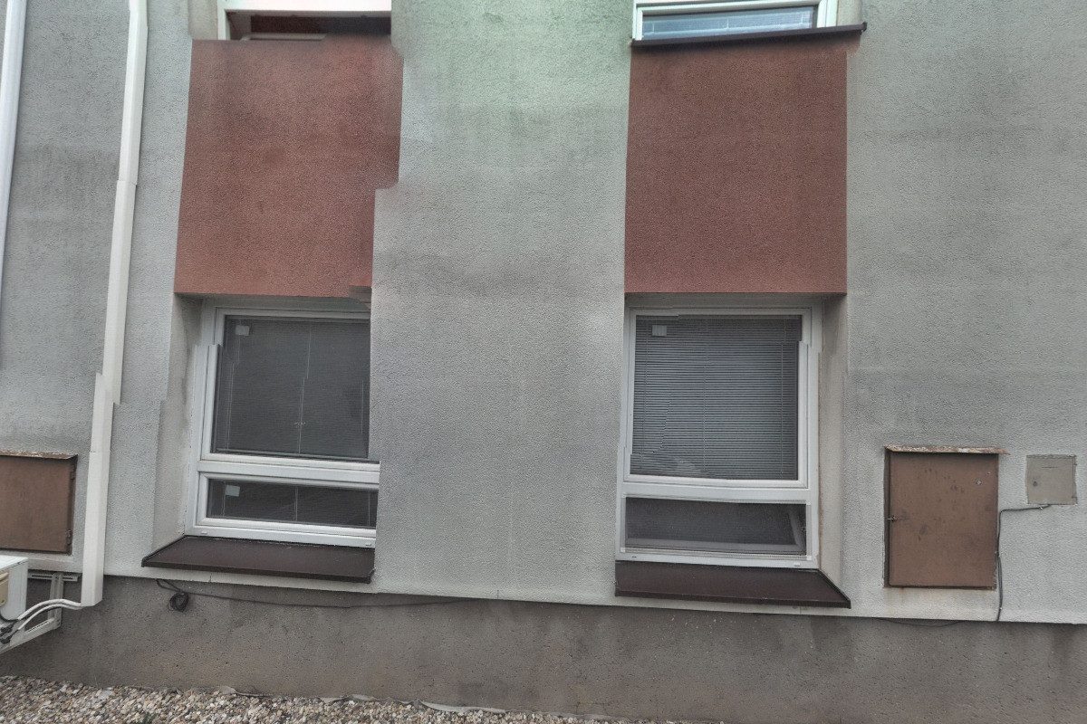 Magnetická rezonance - Oblastní nemocnice Kolín