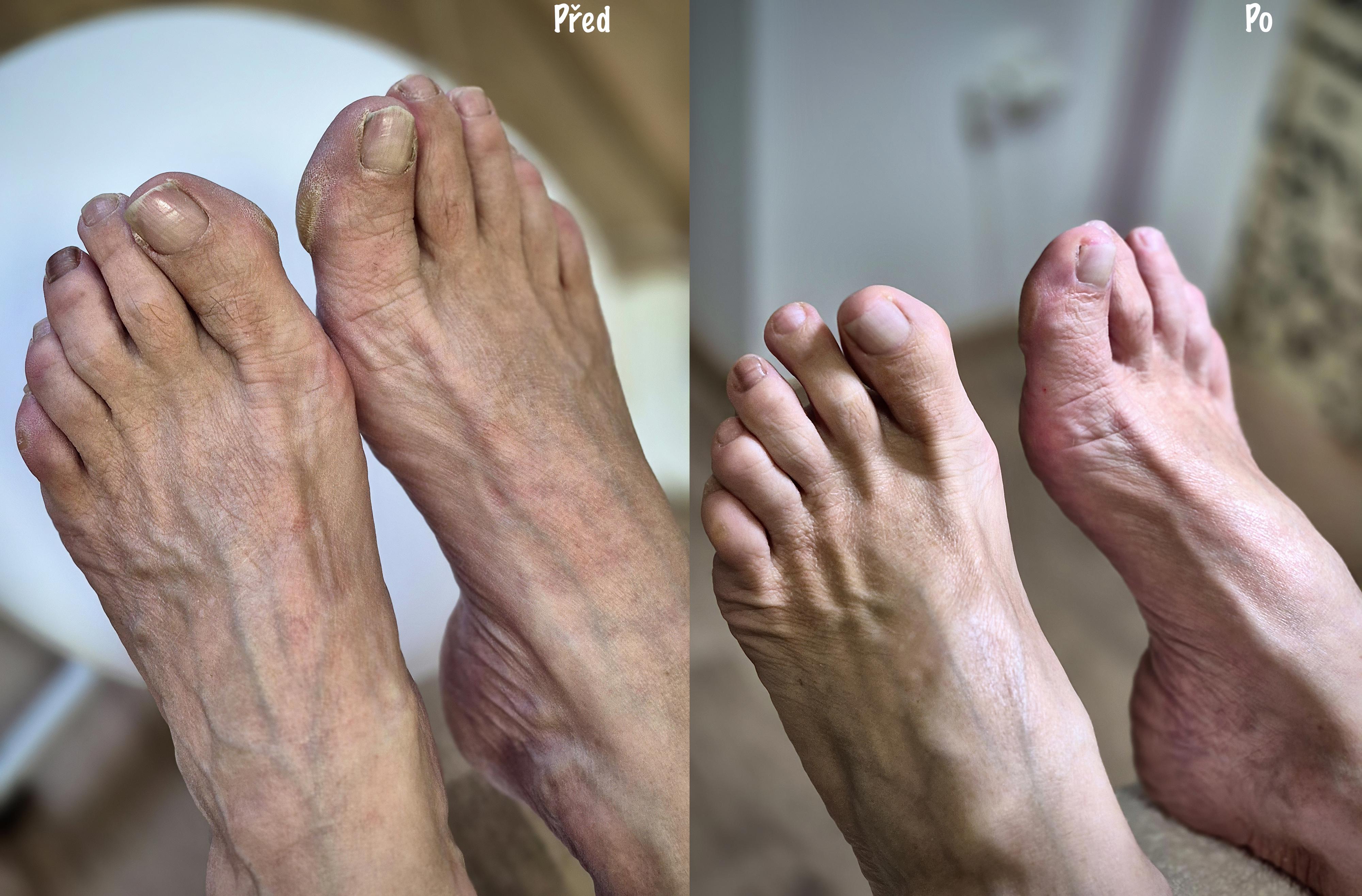 Pedikúra Přidalová Kateřina foto 3