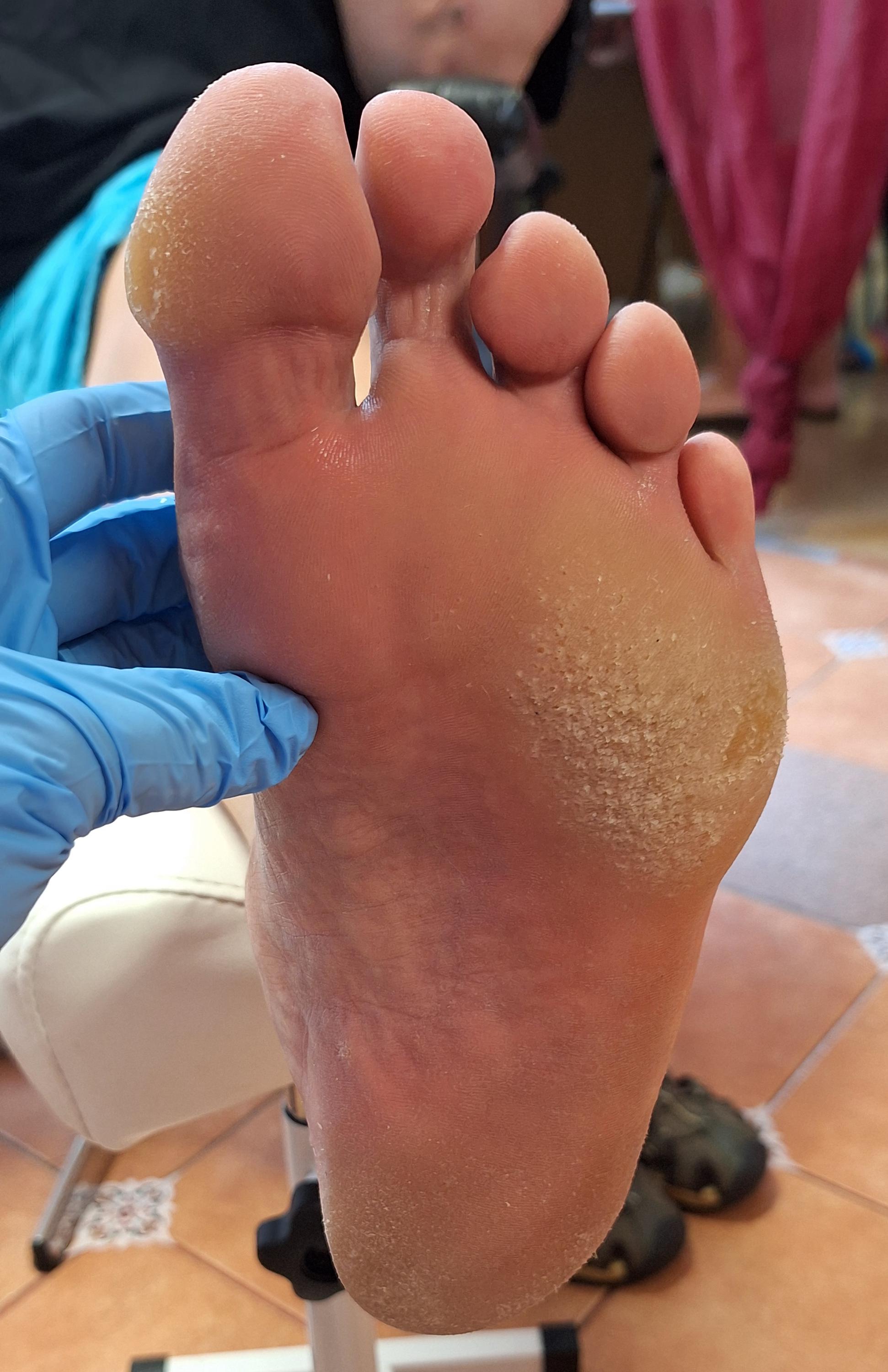 Pedikúra Maria Bajrami Kocajanidu foto 3