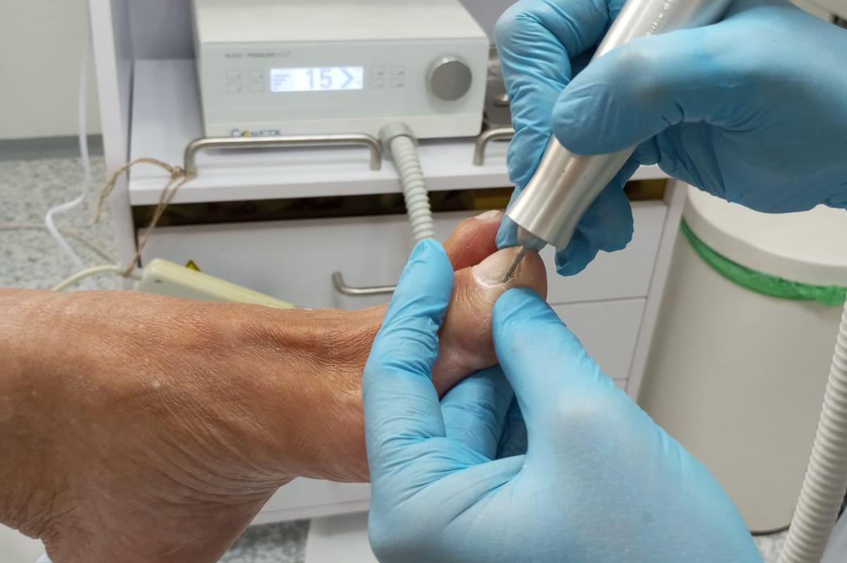 Přístrojová pedikúra Ing. Michaela Koušová