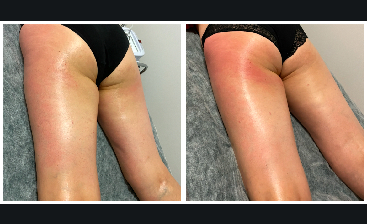 Péče o tělo - Edita Damborská foto 2