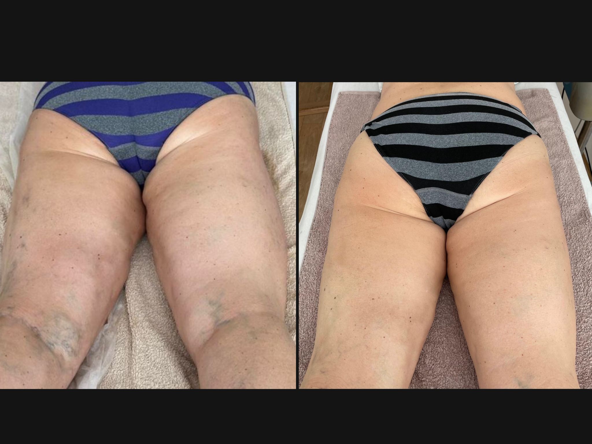 Péče o tělo - Edita Damborská foto 4