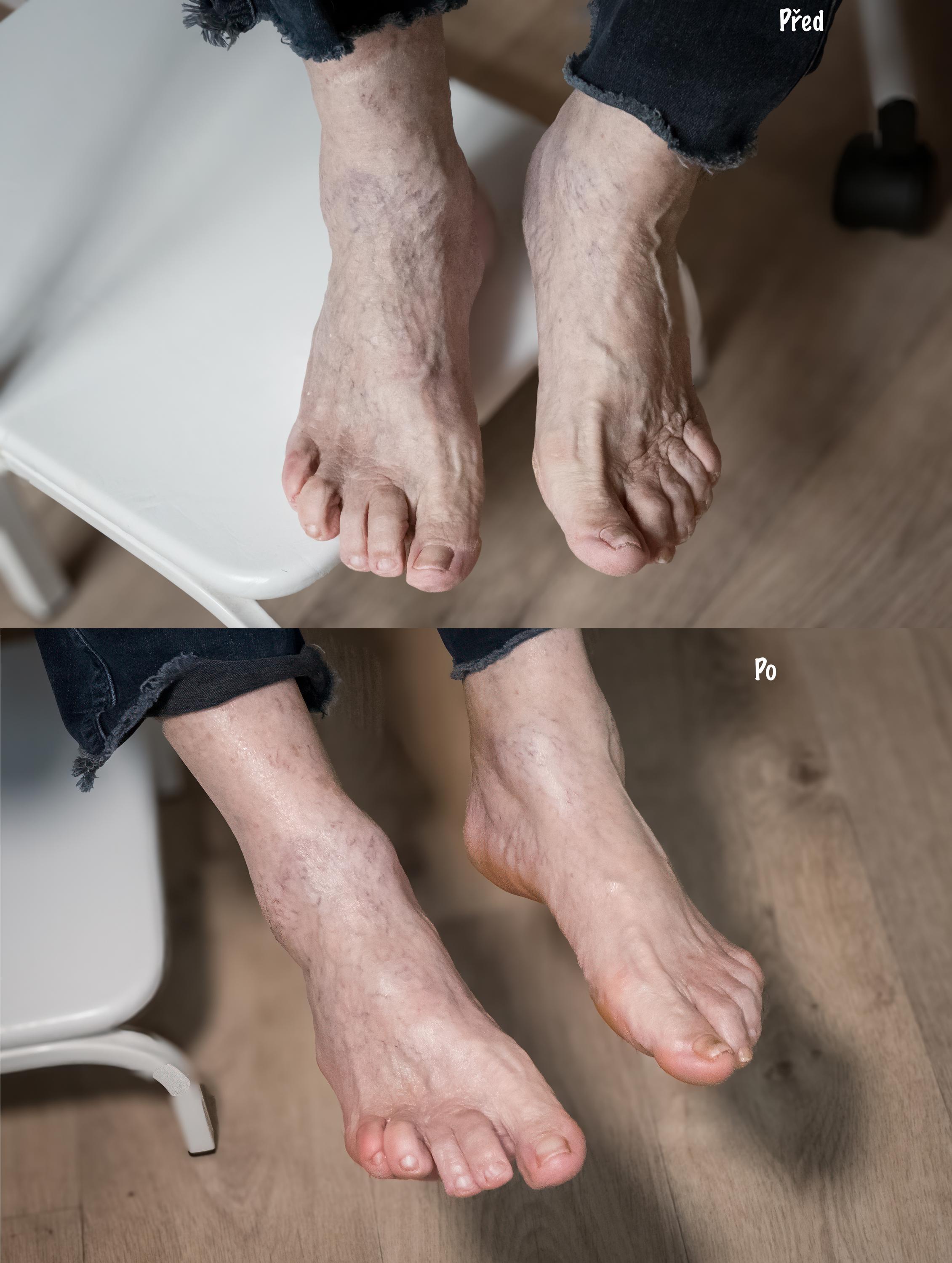 Pedikúra Přidalová Kateřina foto 4