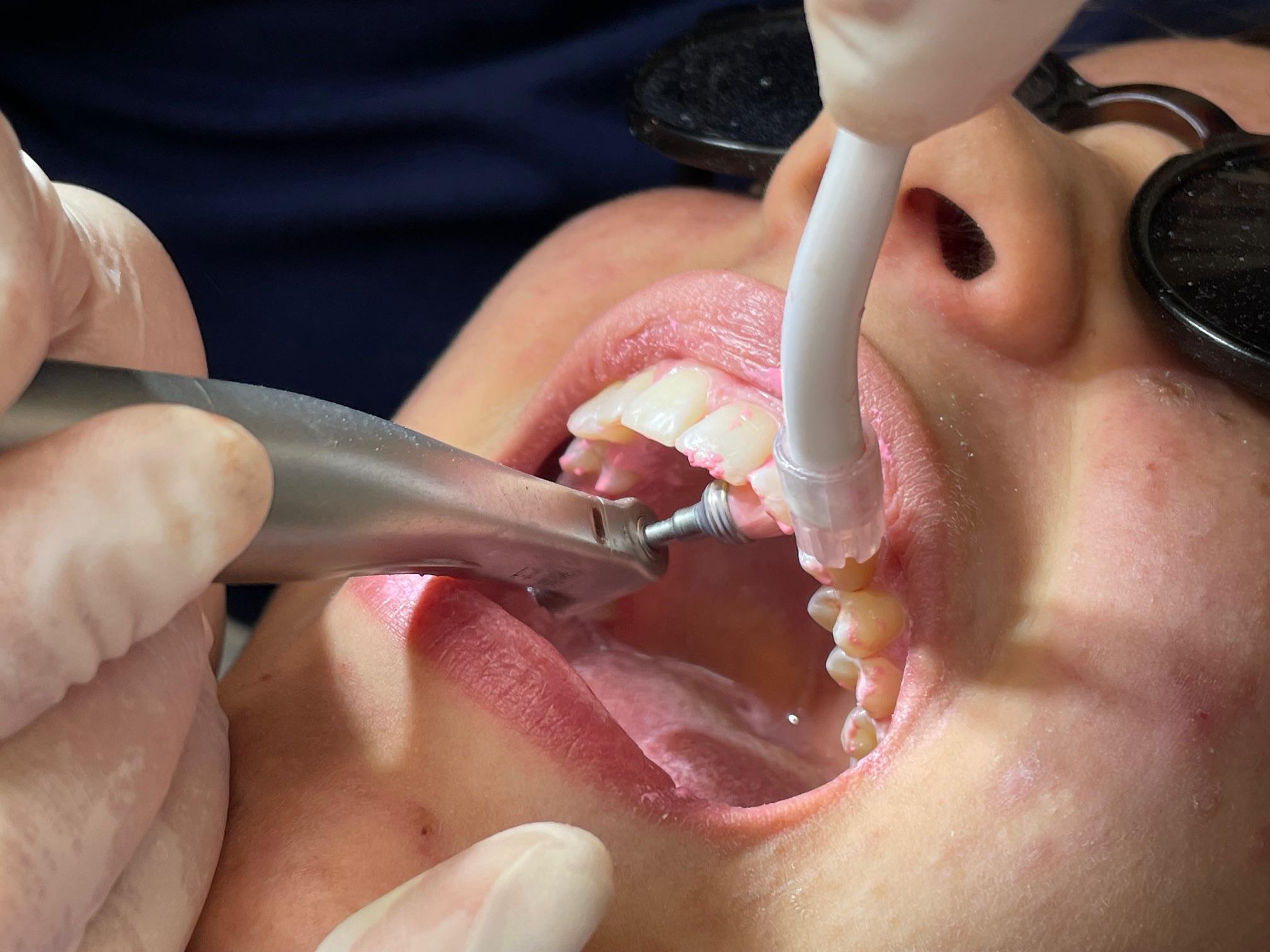 Dentální Hygiena - Lucie Hrášková DiS. foto 2