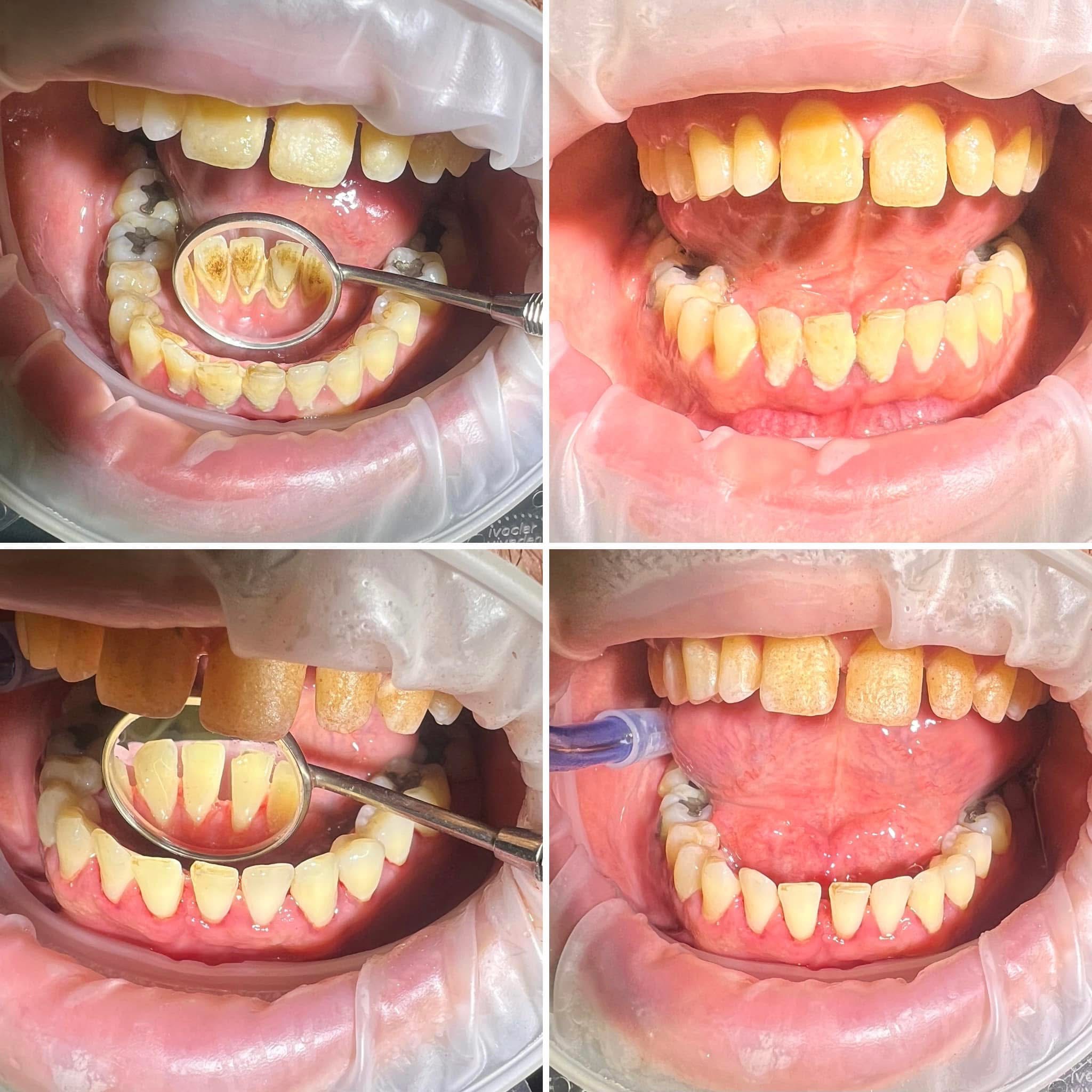 Dentálka NJ foto 3