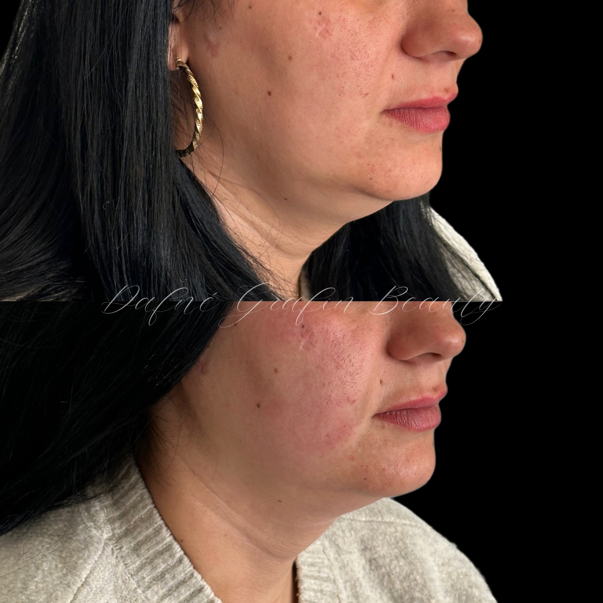 Estetický salon Dafné Gräfin Beauty foto 2