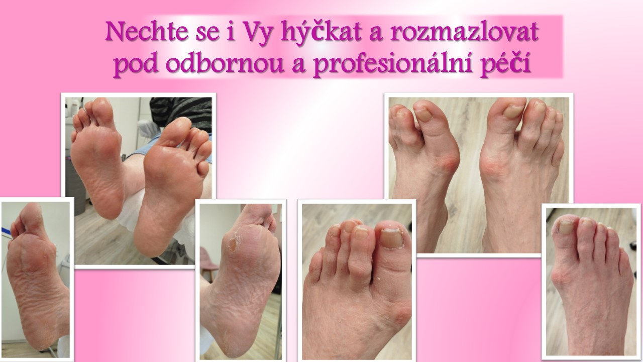 Pedikúra & Manikúra LKŠ foto 3