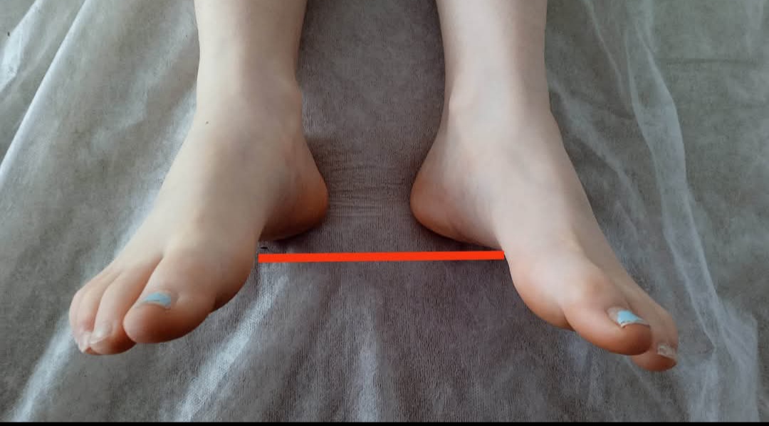 Markéta Nacházelová - manuální terapeut pro lidi a zvířata foto 2